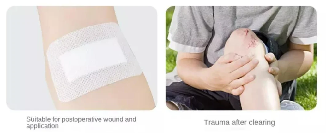 First Aid Kit Accessories Elastic Long Spunlace Non-Woven Fabric Anti-Abrasive Foot Wound Dressing/Tape/Plaster